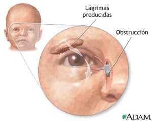 Masaje sobre zona obstruida